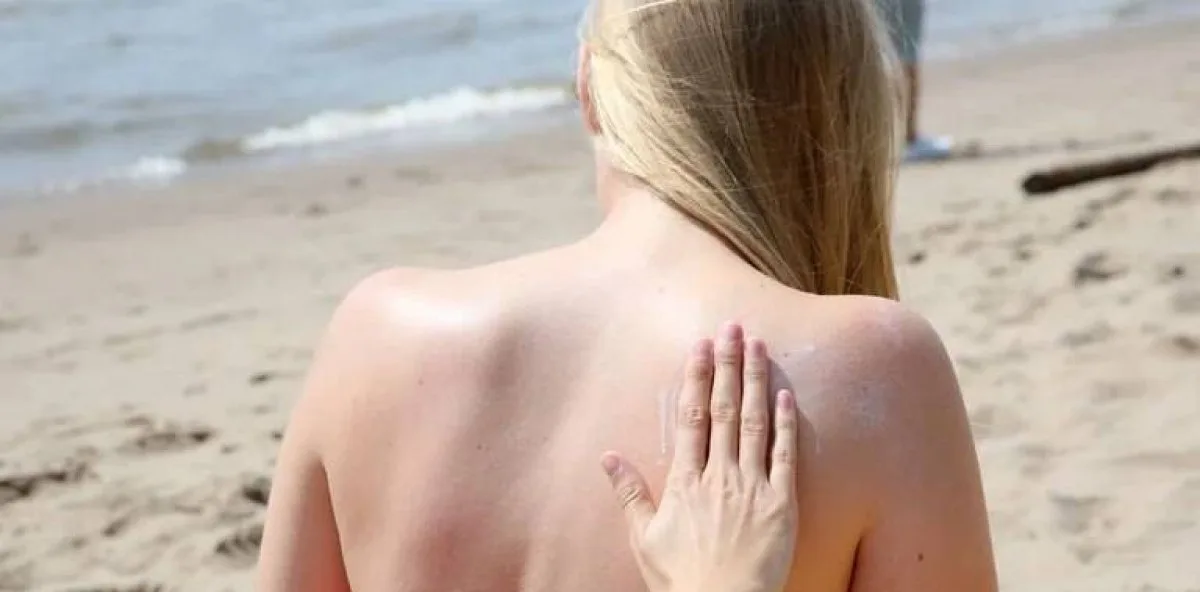 Cómo evitar manchas en la piel durante el verano
