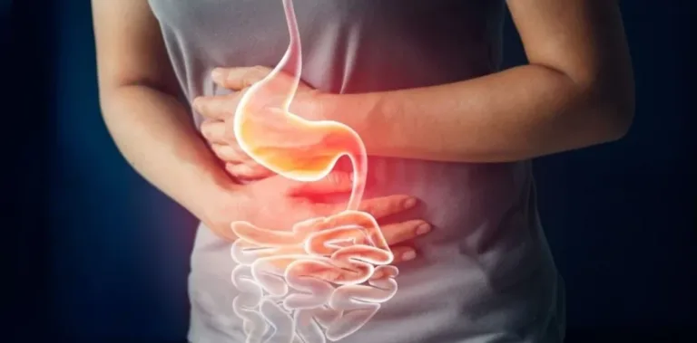 ¿Sufres de acidez con frecuencia? Estos cambios en tu dieta pueden marcar la diferencia