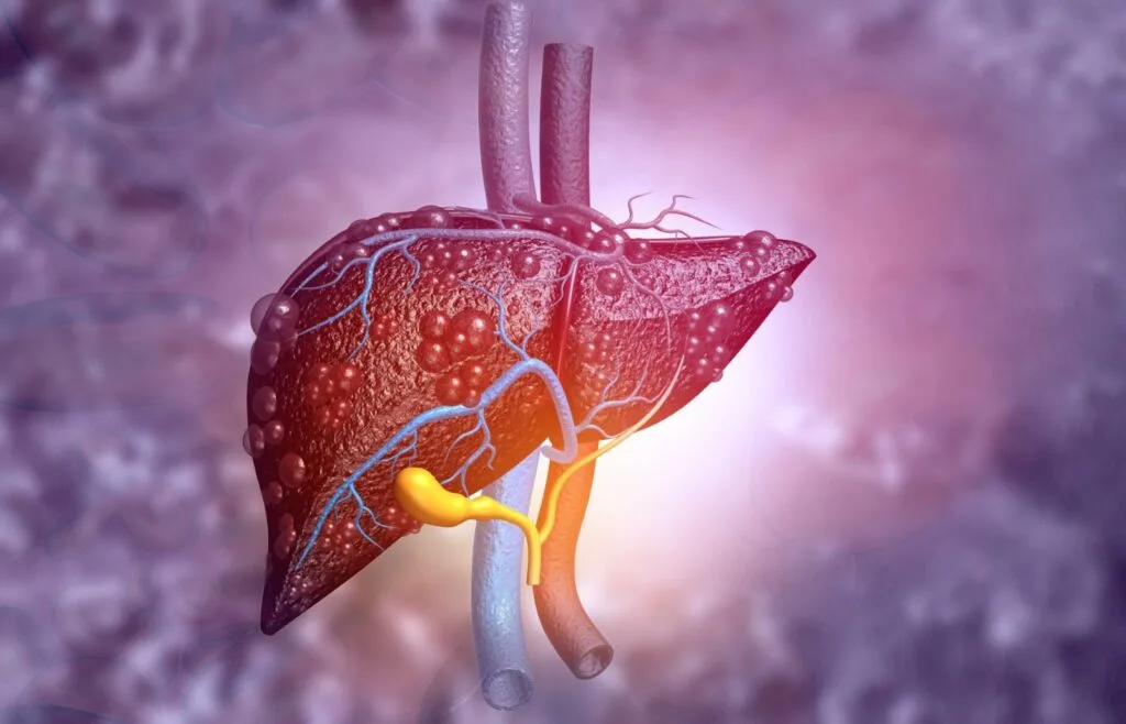 Hepatitis C, una infección que puede curarse en más del 95% de los casos