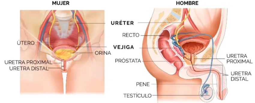 ¿Cómo afecta la calidad de vida en el paciente con estrechez uretral?
