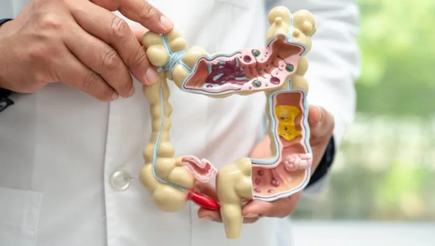 Crohn y colitis ulcerosa son enfermedades crónicas que inflaman el intestino