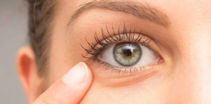 Incrementa el síndrome del "ojo seco": ¿Qué es y cómo se relaciona con el calor y aire acondicionado?