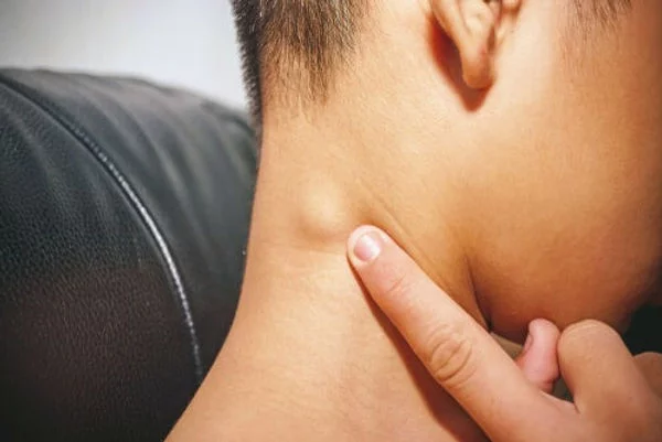 Ganglios inflamados: ¿cuándo son normales y cuándo debes preocuparte?