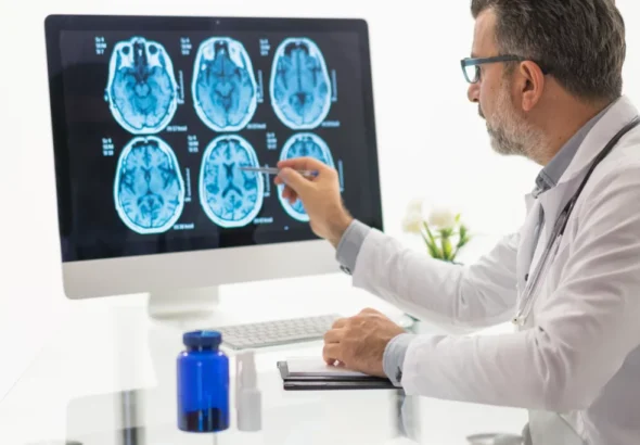 Cambios cerebrales por Alzheimer