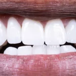 Microbioma bucal en 2026