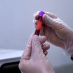 Una muestra de sangre permite diseñar inmunoterapias personalizadas contra el cáncer