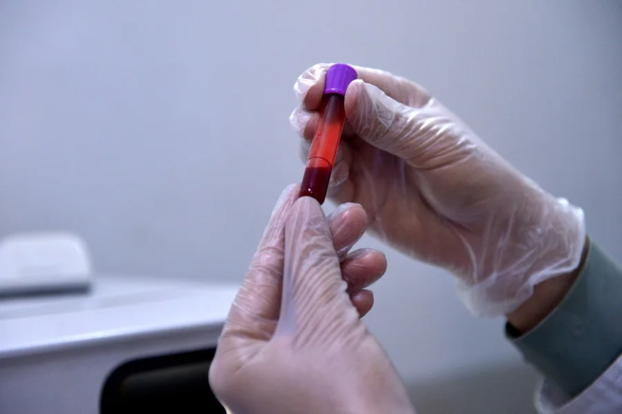 Una muestra de sangre permite diseñar inmunoterapias personalizadas contra el cáncer