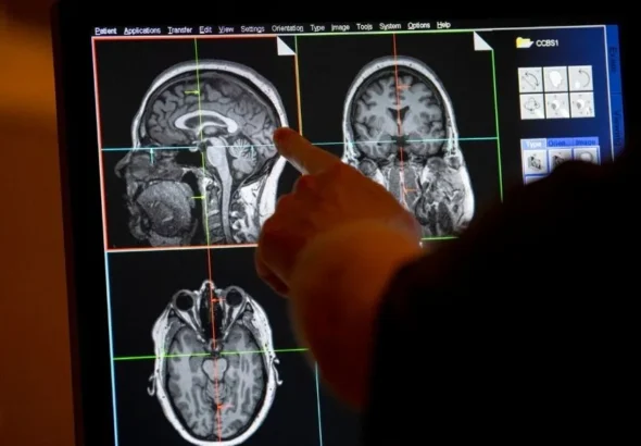 Especialistas advierten diagnóstico de ataxia puede tardar más de 10 años