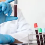 detección de hepatitis B y C