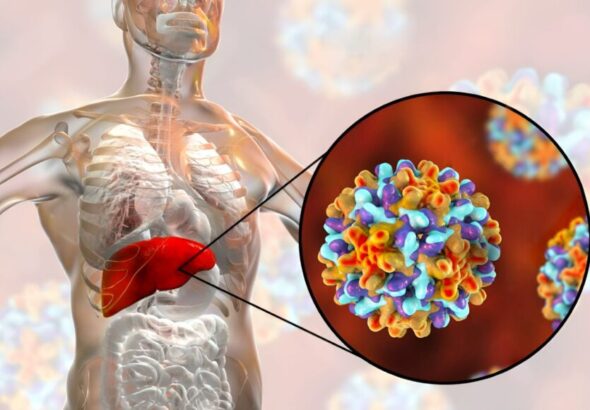 hepatitis B y C
