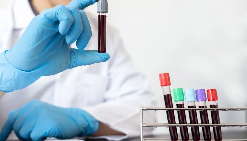 detección de hepatitis B y C
