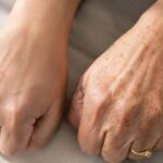 eliminar manchas en la piel