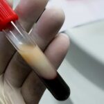 ¿Te suben los triglicéridos por la grasa que comes... o por el arroz, el pan y el jugo?