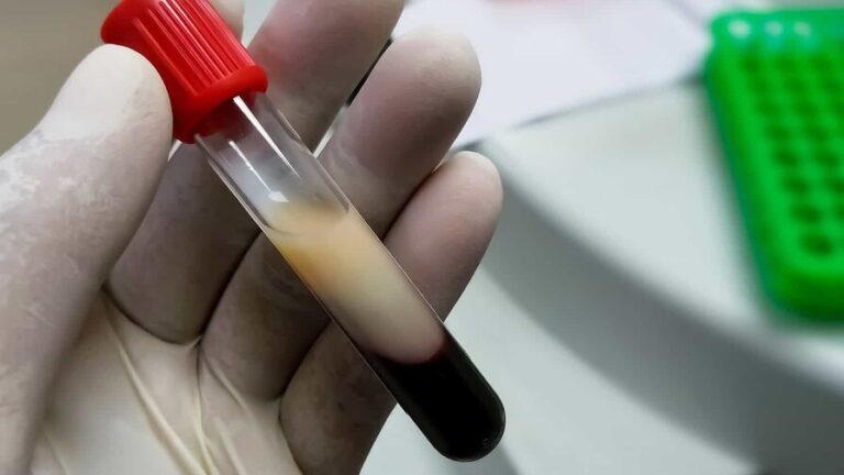 ¿Te suben los triglicéridos por la grasa que comes... o por el arroz, el pan y el jugo?