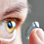 Queratocono: Especialista advierte seguros no cubren lentes de contacto esclerales