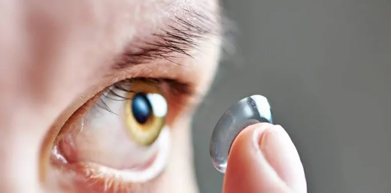Queratocono: Especialista advierte seguros no cubren lentes de contacto esclerales