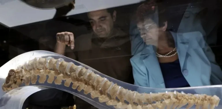 La osteoporosis secundaria: cuando la enfermedad no viene sola