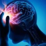 Accidentes Cerebro Vasculares aumentan de forma preocupante en el país