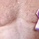 Cáncer de mama masculino: El riesgo aumenta con la edad, explica experta de Mayo Clinic