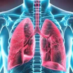 Hipertensión arterial pulmonar: síntomas y diagnóstico tardío preocupan en América Latina