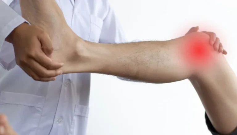Osteoporosis también aumenta entre personas menores de 50 años