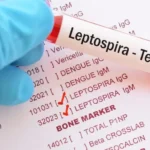 Leptospirosis suma 20 muertes y los casos confirmados aumentan un 87 %